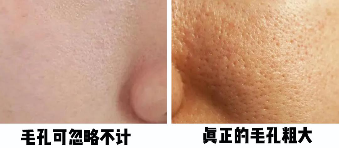 怎樣毛孔可以慢慢縮小，護(hù)膚秘籍與實(shí)用建議，護(hù)膚秘籍，縮小毛孔實(shí)用建議與指南