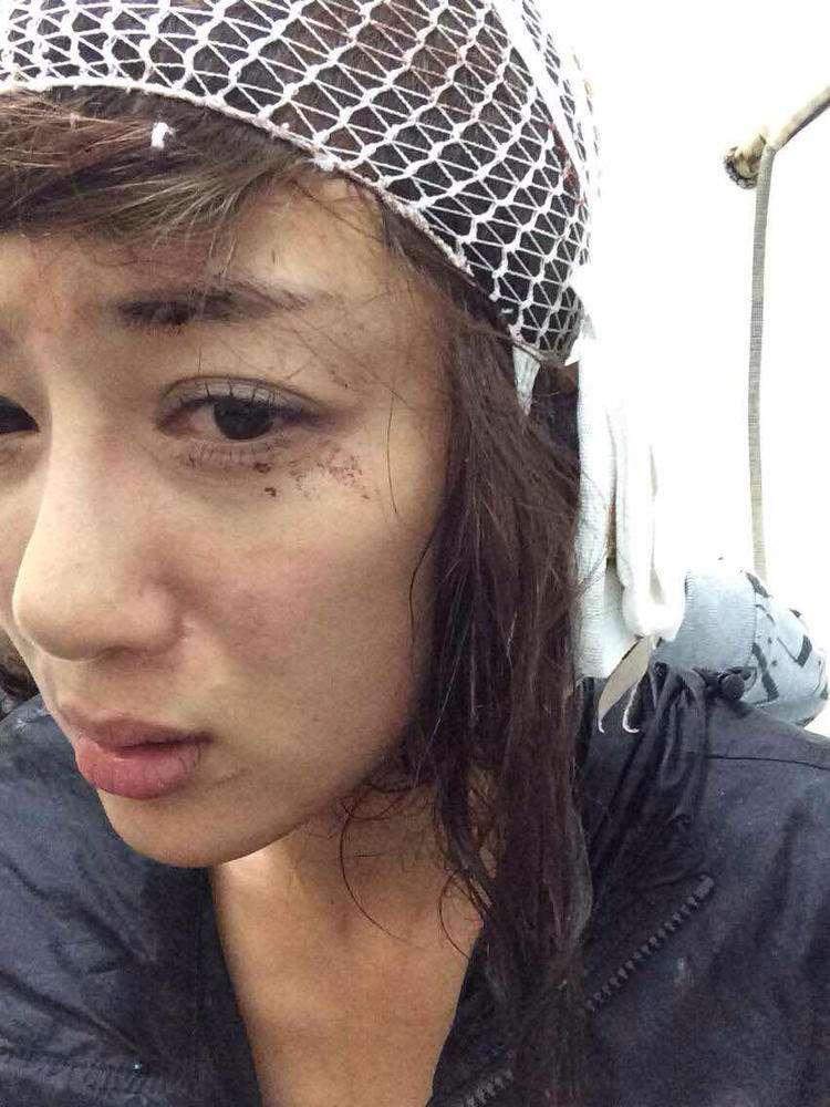 明星整容毀容最嚴重的是誰，深度探討與反思，深度探討與反思，哪位明星整容遭遇最慘重的毀容？