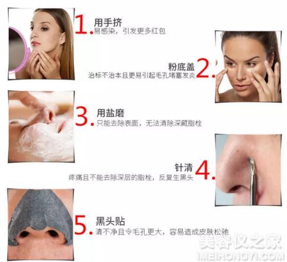 去黑頭的簡單小妙招，去黑頭小妙招分享，輕松告別黑頭困擾