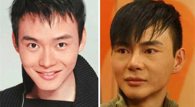 整過容的男明星名單，揭秘娛樂圈的顏值變革之旅，揭秘娛樂圈顏值變革之旅，整過容的男明星名單曝光