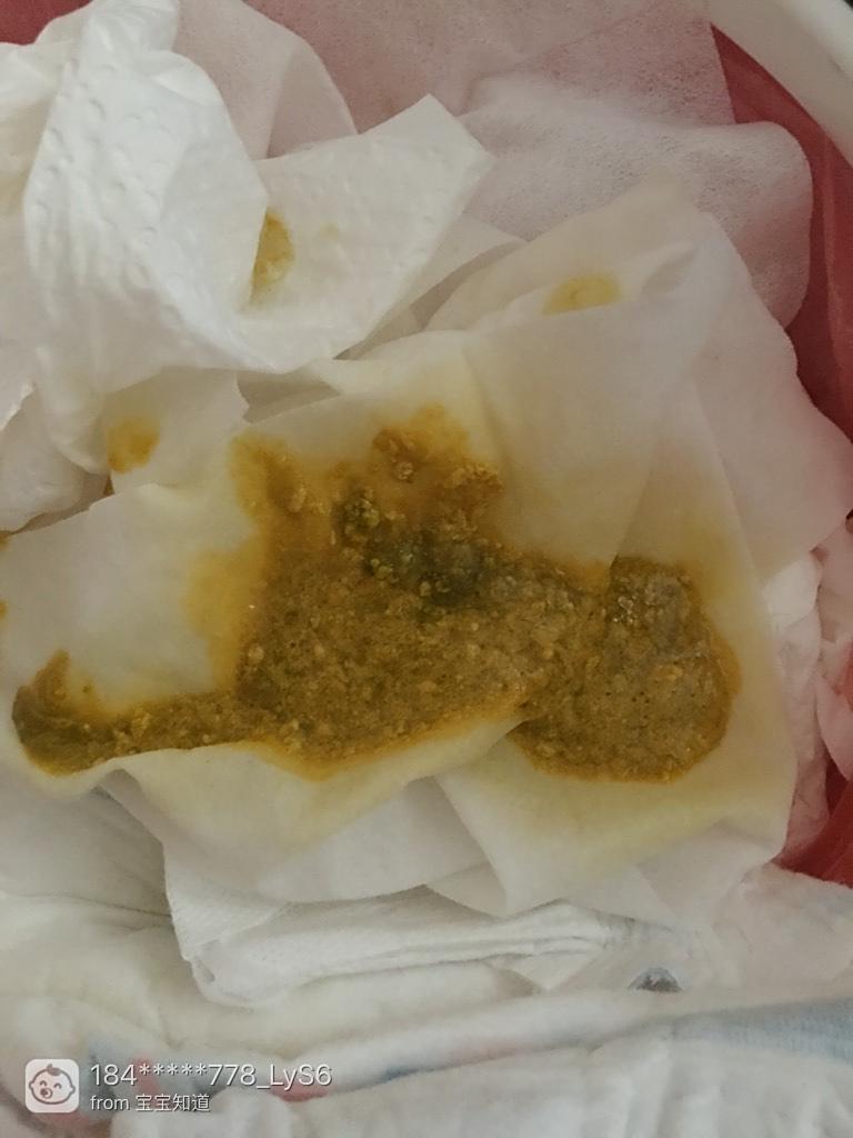 關于4個月的寶寶拉肚子怎么辦的全方位指南，4個月寶寶拉肚子應對指南，全方位解決方案
