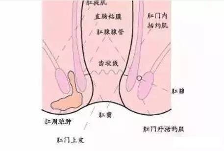 肛門息肉早期圖片及其相關介紹,肛門息肉早期圖片與詳細介紹