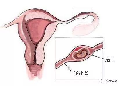 排卵的表現癥狀,深入了解女性生理周期的重要一環,深入了解女性生理周期,排卵表現癥狀解析