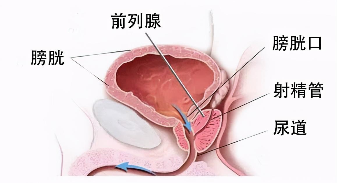 全面解析滑膜炎治療,如何根除病因,恢復健康,全面解析滑膜炎治療,根除病因,重塑健康之路