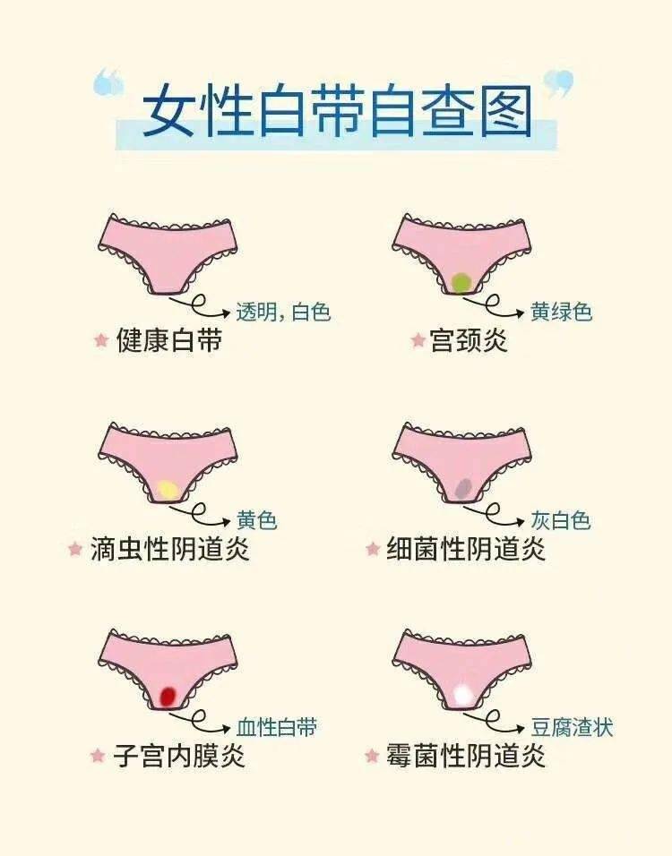 關(guān)于白帶,了解、關(guān)注與呵護(hù)女性健康的重要一環(huán),女性健康的關(guān)鍵,了解、關(guān)注與呵護(hù)白帶的重要性