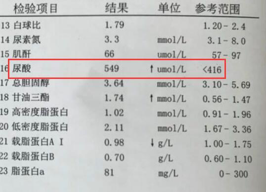 痤瘡忌口食物清單,戰(zhàn)勝痘痘,從飲食開始,戰(zhàn)勝痘痘,痤瘡忌口食物清單助你調(diào)整飲食,遠(yuǎn)離皮膚困擾