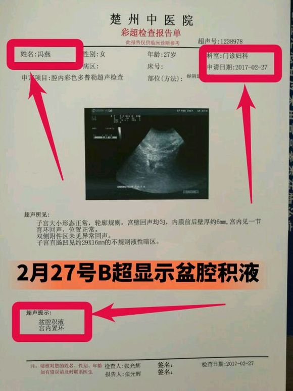 盆腔積液怎么治療,全面解析最佳治療方案,全面解析,盆腔積液的最佳治療方案