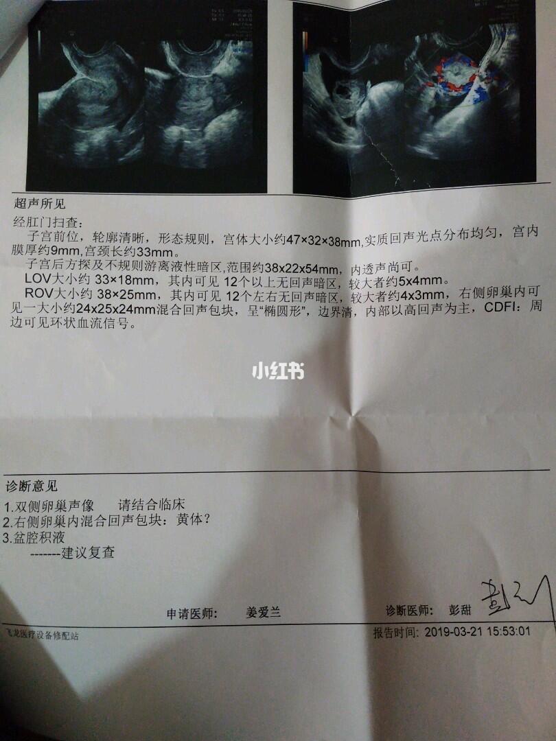盆腔積液怎么治療,全面解析最佳治療方案,全面解析,盆腔積液的最佳治療方案