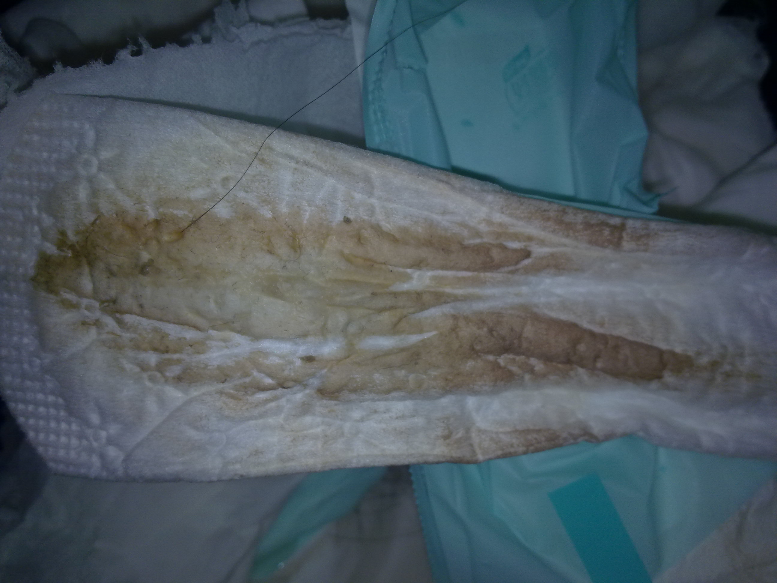 非經期下體流黑褐色分泌物,原因、影響與應對措施,非經期下體黑褐色分泌物,原因、影響及如何應對