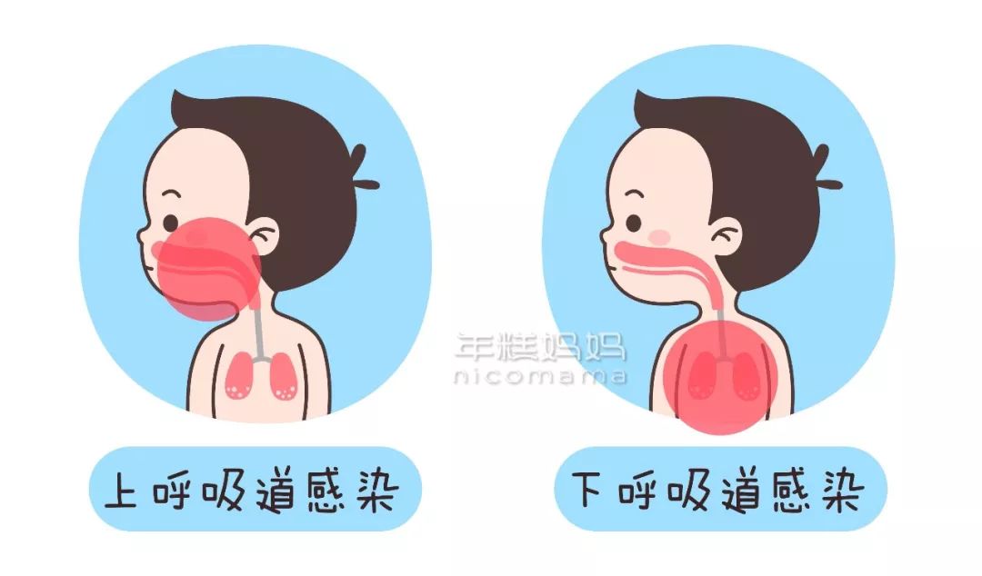 肺炎與普通咳嗽的區(qū)別,深入了解癥狀、起因及應對方法,肺炎與普通咳嗽的區(qū)別詳解,癥狀、起因和應對方法指南