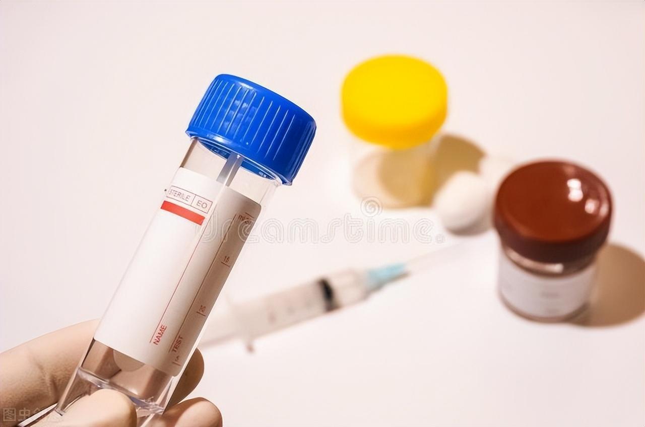 如何判斷是否得了痔瘡,痔瘡的判斷方法詳解