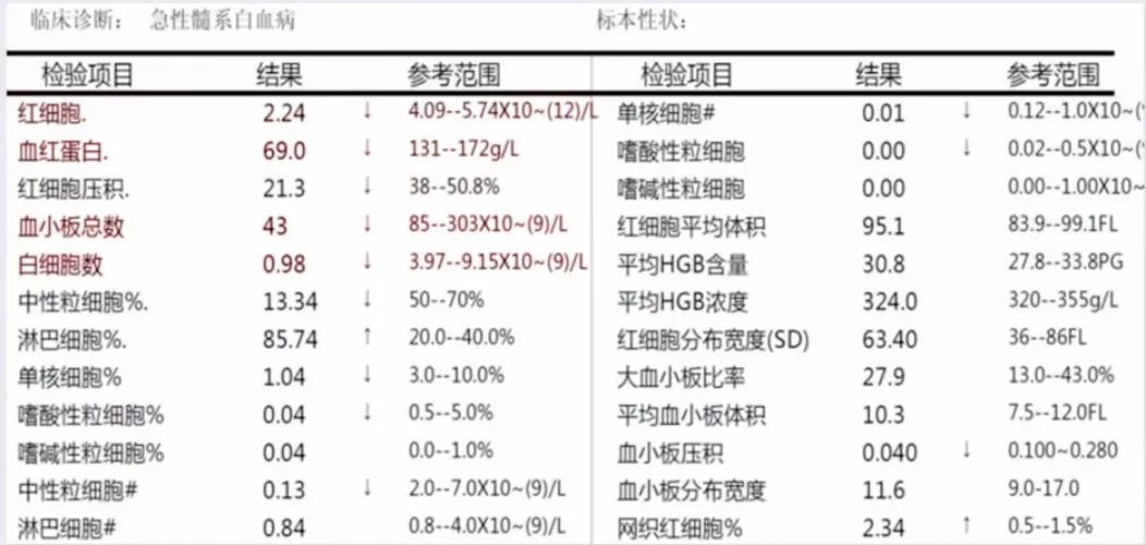 血常規能查出白血病嗎?——深入了解血常規檢查與白血病的關聯,血常規檢查能否揭示白血病真相?——探究血常規與白血病的深層聯系