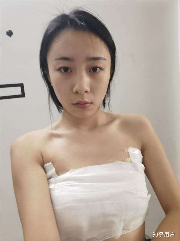 隆胸五年的感受,我的親身經歷與體驗分享,隆胸五年的真實感受,我的親身經歷與深度體驗分享