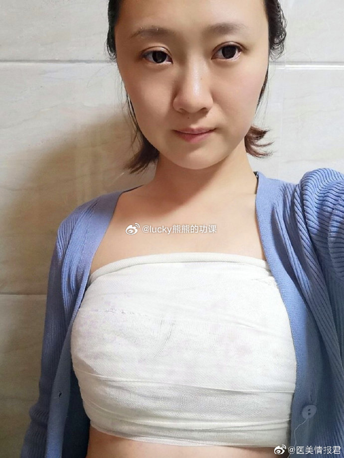 隆胸五年的感受,我的親身經歷與體驗分享,隆胸五年的真實感受,我的親身經歷與深度體驗分享