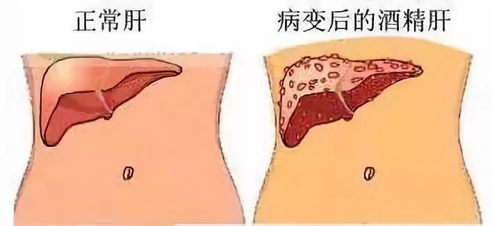 肝不好有什么癥狀,全面解析與關注,全面解析關注,肝臟不良癥狀的表現