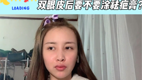 關于40歲割雙眼皮是否適合的全面解析,40歲割雙眼皮的適宜性與全面解析