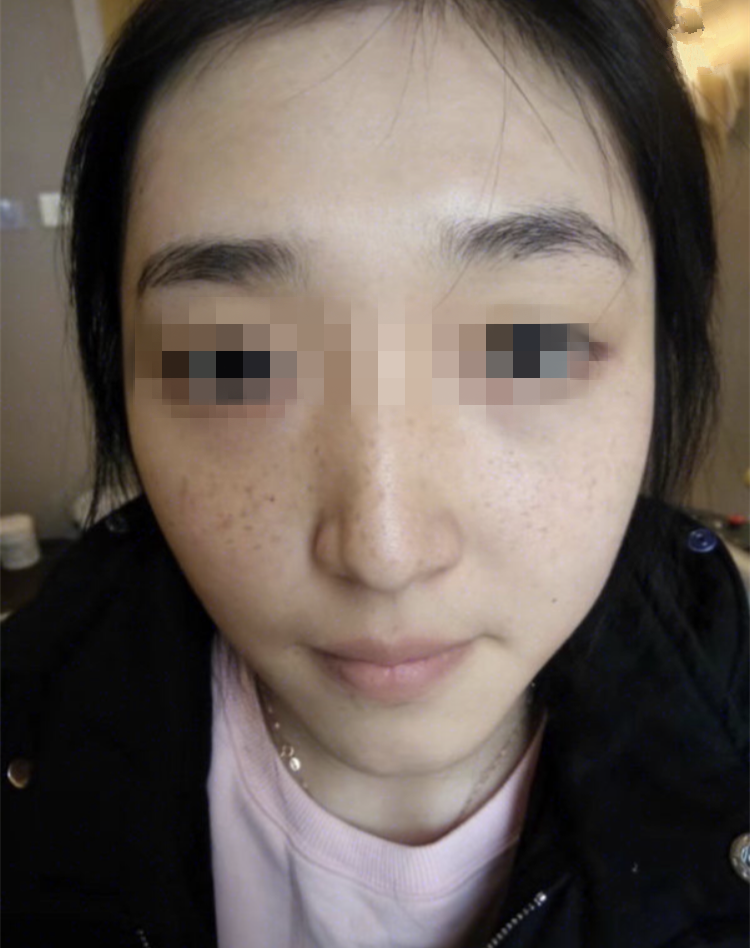 正規(guī)醫(yī)院祛斑效果深度解析,安全與效果的雙重保障,正規(guī)醫(yī)院祛斑效果深度解析,雙重保障下的安全與效果體驗