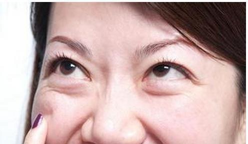 如何消除眼袋，方法與技巧詳解，消除眼袋的有效方法與技巧全解析