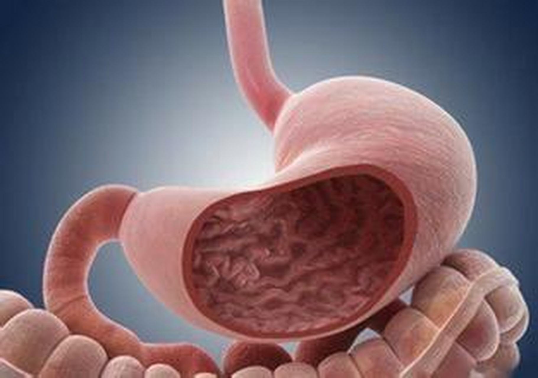 淺表性胃炎的癥狀及其影響,了解、預防與治療,淺表性胃炎的癥狀、影響、預防與治療全解析