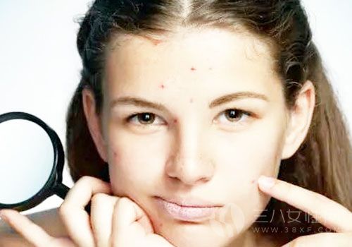 如何去掉青春痘小妙招,實用指南助你擺脫肌膚困擾,青春痘消除小妙招,實用指南助你擺脫肌膚問題