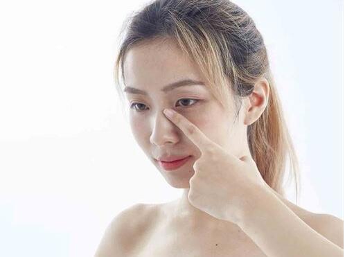 如何去除魚尾紋,最佳方法與實用建議,去除魚尾紋,最佳方法與實用建議攻略