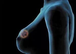 乳腺癌患者的生存期，了解與面對，乳腺癌患者的生存期，了解與面對的挑戰