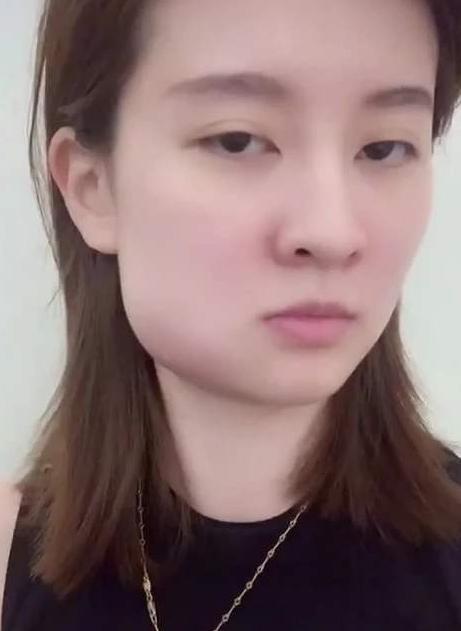 拔智齒多少錢一顆?一文解讀智齒拔除費(fèi)用(2022年),2022年智齒拔除費(fèi)用詳解,拔智齒多少錢一顆?一文解讀智齒拔除費(fèi)用問題。