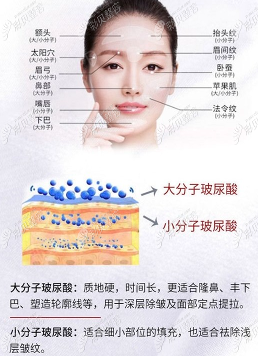 玻尿酸的作用與功效,深入了解玻尿酸的奧秘,玻尿酸的作用與功效揭秘,深入了解玻尿酸的神奇之處